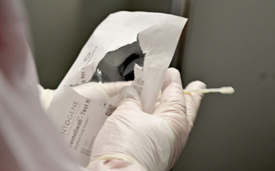 Kita, Alles bereit zum Abstrich. Das Wattestäbchen kommt in den Rechen.