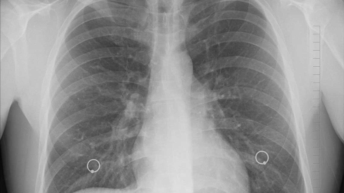 Röntgenkongress kehrt nach Wiesbaden zurück