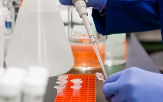 Labor, Symbolbild, Corona-Zahlen