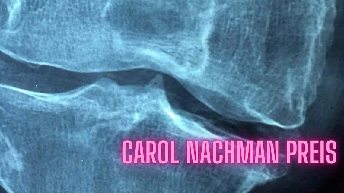 Carol Nachman Preis