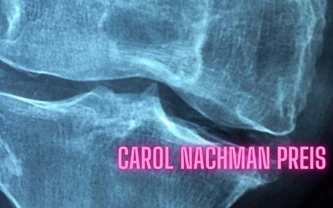 Carol Nachman Preis