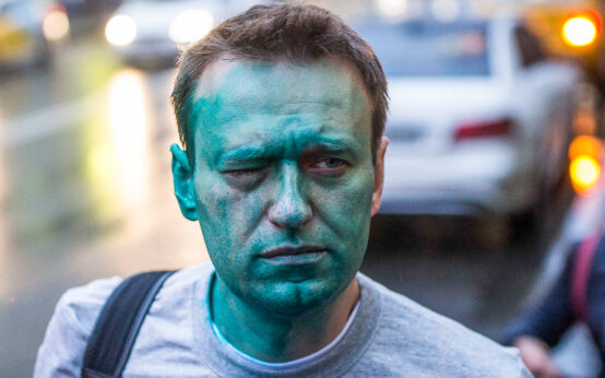 Nawalny nach einer Seljonka-Attacke im Jahr 2017