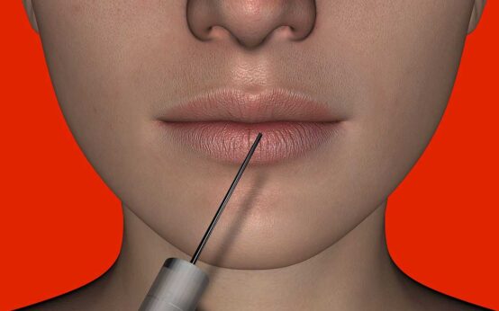 Behandlungen mit Hyaluronsäure im Kosmetikstudio.