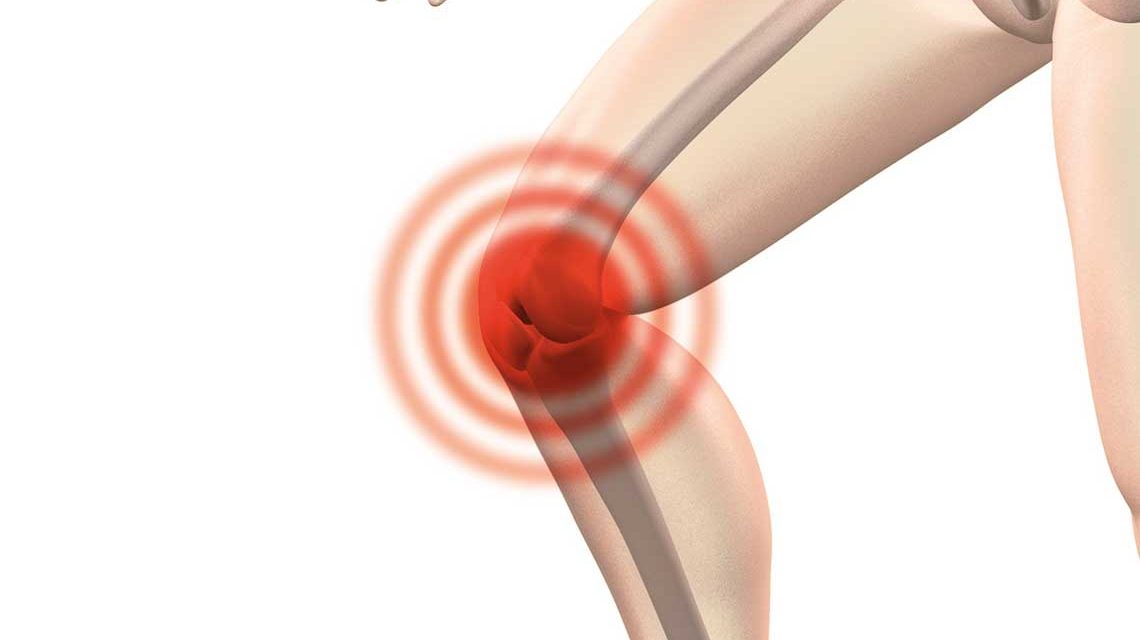 Das Knie, Thema bei Verständlicher Medizing