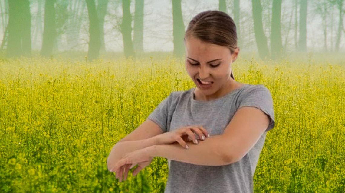 Hautpflege im Winter: Besondere Tipps für Neurodermitis-Betroffene