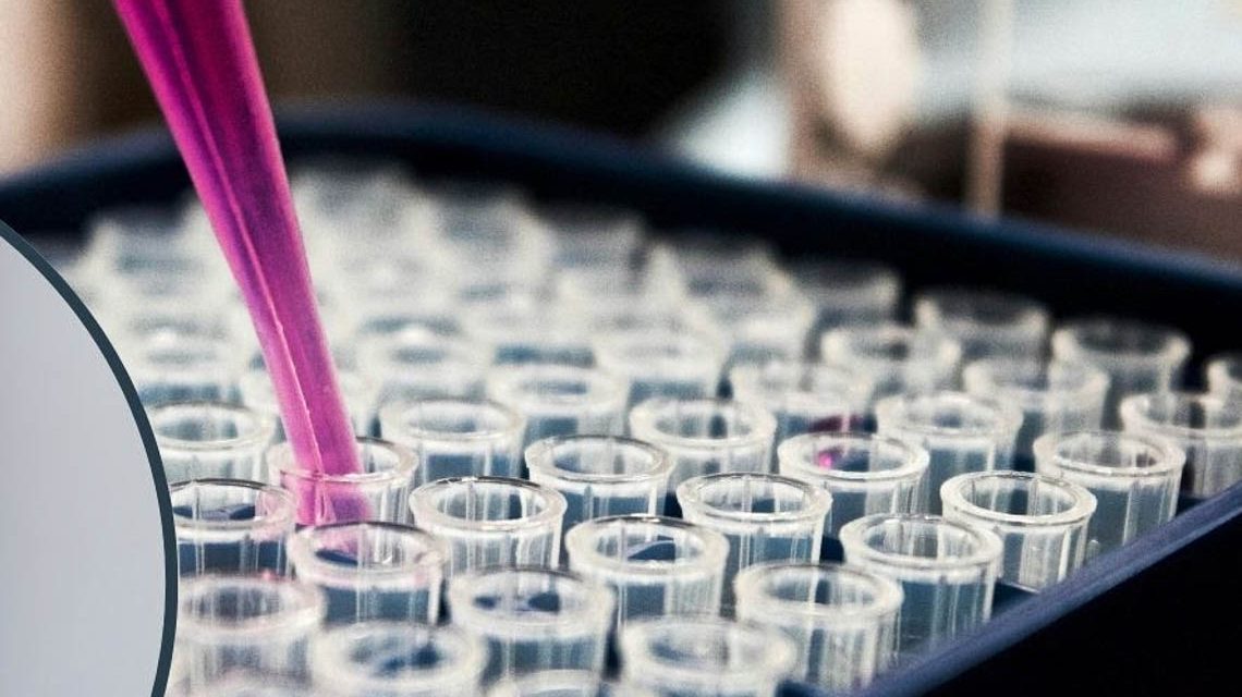 „Dr. Alexander Mayer demonstriert die neue Stammzellentherapie an der ATOS Klinik Wiesbaden – schonend, minimalinvasiv, zukunftsweisend.“