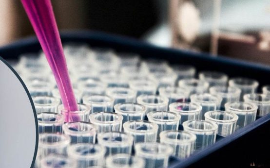 „Dr. Alexander Mayer demonstriert die neue Stammzellentherapie an der ATOS Klinik Wiesbaden – schonend, minimalinvasiv, zukunftsweisend.“